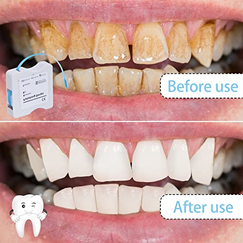 Tooth Polisher Dental File, Teeth Abrasive & Finishing Strips 4Mm X 6M- Tooth Polish Abrasive Strip Oral Care Cleaning Tool (Blue) #TOP4