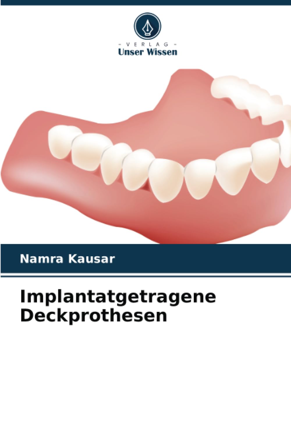 Implantatgetragene Deckprothesen