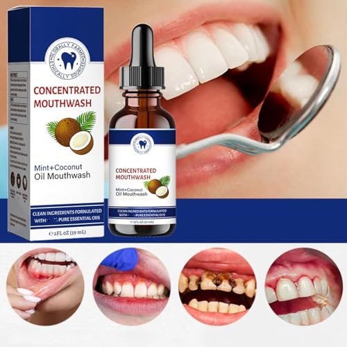 2 Stücke Kokosöl Mundspülung, Bio Kokosnuss-Mundspülung, Kokosöl-Pulling für Zähne, Kokosnussöl Mundwasser ätherisches ö, Frischer Atem & Aufhellende Mundspülung – Bild 4