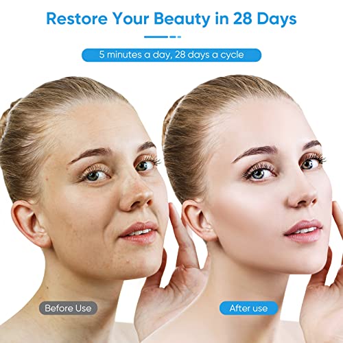 Microcurrent Facial Device, Usb Rechargeable Face Massager/Face Sculpting Tool/Face Lift Device, Anti Aging, Skin Tightening & Rejuvenation #TOP5