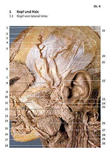 Image of Lernkarten Anatomie