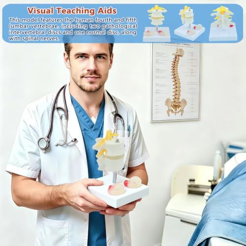 Image of 2 Section Lumbar Intervertebral Disc Human Skeleton Spine Model,Anatomical Vertebrae Model for Chiropractic,Patient Education Demonstration,Excellent Way for Demonstrating Disc