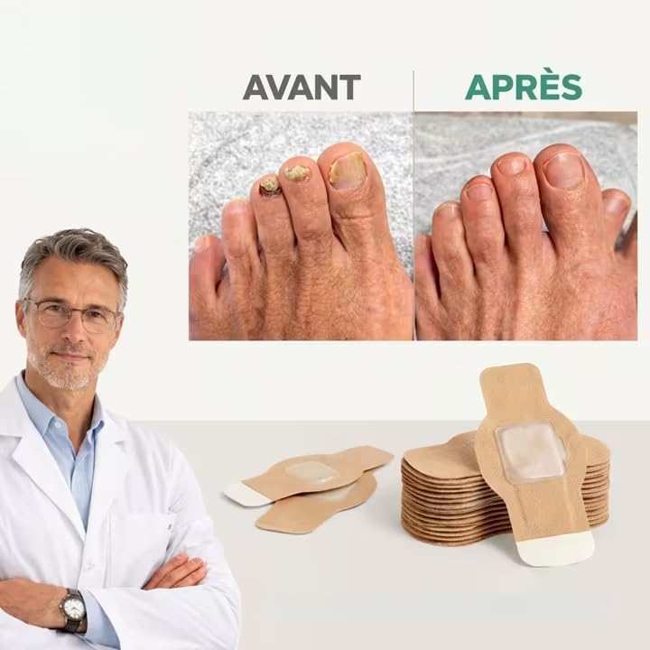 Patch Antifongique Ongle Dermisya Amélioration Visible et Application Nuit - 3