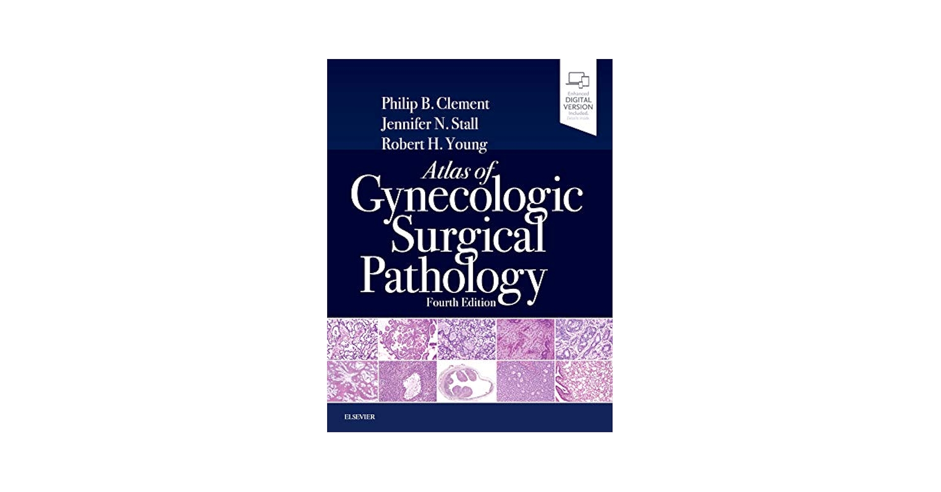 Atlas of Gynecologic Surgical Pathology: Expert Consult