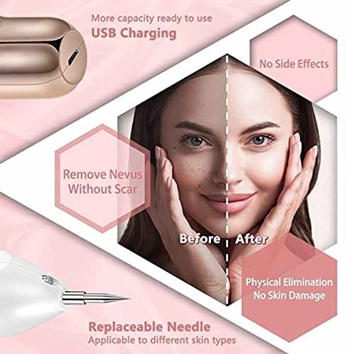 Aravli Laser Freckle Spot Dot Mole Remover for Face Beauty Equipment Tattoo Plasma Mole Removal Pen Tool Machine for Women (Pink) - Image 4