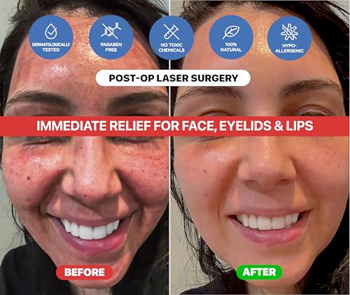 Dr. Arsy Eczema Cream for Adults & Kids – Hypoallergenic Barrier Repair Moisturizer, Clinically Proven (3 Studies), Fragrance-Free, Dermatologist Tested, Face & Body Hydration, NEA Accepted, USA Made