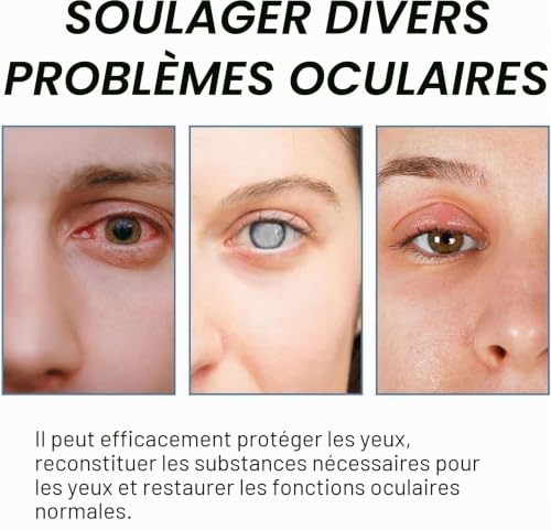 Gouttes pour la réduction de la myopie, gouttes pour les yeux pour la myopie, gouttes pour le bien-être des yeux pour la solution des problèmes oculaires, vue claire (3 pièces-B#) – vue 6
