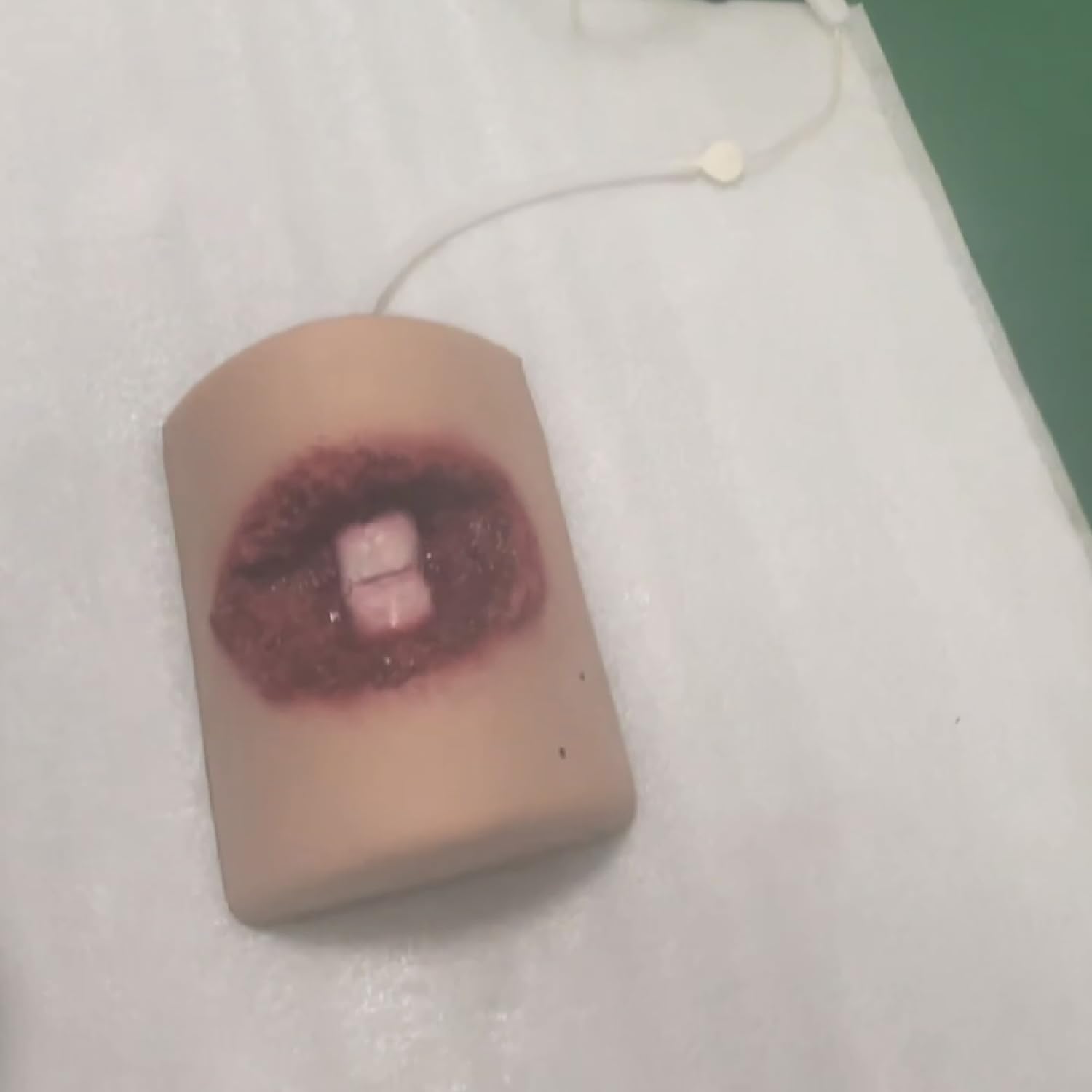 Modèle De Fracture Ouverte, Kit D'entraînement d'emballage De Plaie, Modèle De Simulateur De Lacération Réutilisable, Pratique De Suture D'entraîneur De Plaie, pour Pratiquer Les Techniques