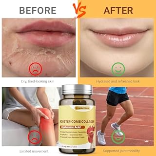 QIFEISHANKA Rooster Comb Collagen, Natural Hyaluronic Acid Supplement for Joint Support, Mobility & Skin Hydration – 120mg 60 Capsule