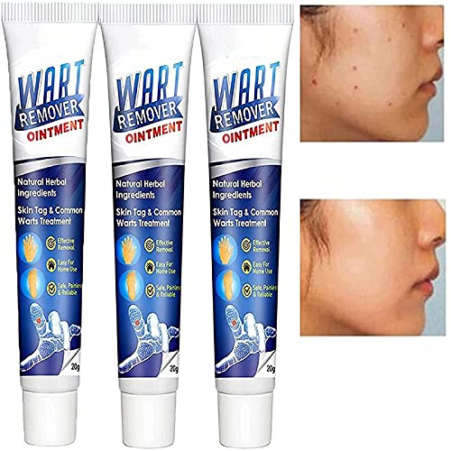 Wart Remover Ointment, Instant Blemish Removal Gel Wart, Flat Wart Cream, Skin Tag Remover Cream, Wart Treatment Cream, Instant Spot Removal Gel, Body Warts Removal, Wart Removal Cream (3pcs)