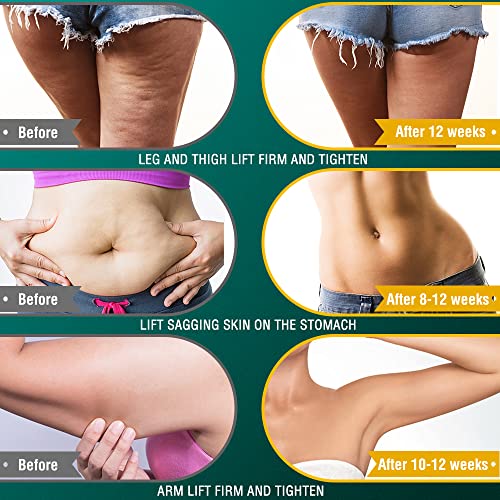 Rf Radio Frequency Machine | Anti Aging | Skin Care | Portable Handheld Rf Machine For Facial Neck Arm Waist Buttocks Legs (Stylish, Multi) #TOP4