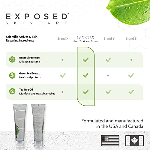 Exposed Skin Care Acne Treatment Serum Step 3 – Quickly Reduces Pimple Size And Redness - 12 Hour Spot Treatment - 3.5% Benzoyl Peroxide, Natural Green Tea & Tea Tree Oil #TOP4