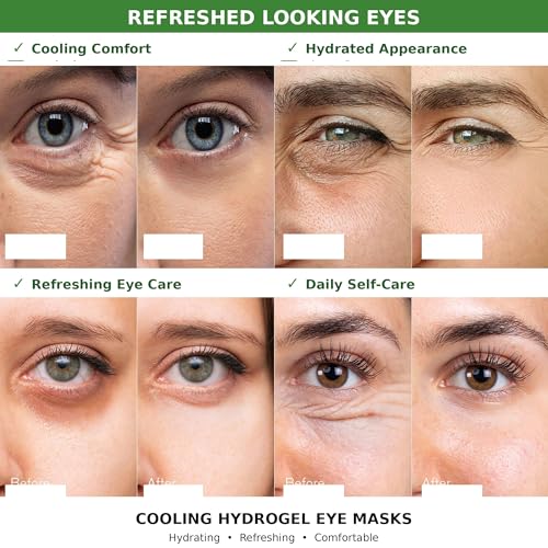 Image of Enaskin Naturals Under Eye Patches for Women and Men: 30 Pairs Green Tea Eye Masks with Caffeine, Collagen & Hyaluronic Acid - Cooling Hydrogel Eye Gels for Refreshed-Looking Skin (Green Tea)