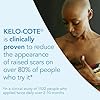 KELO-COTE Scar Gel 15g – Silicone Scar Treatment - Clinically proven to reduce raised scars - Reduces Redness & Itching, Ideal for Surgical, Burn & Acne Scars - Old & New Scars #2