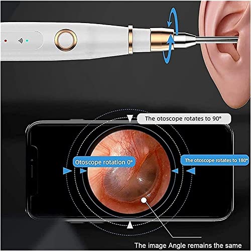 Mxjcc Ear Wax Removal Kit Upgraded All In One Ear Cleaing Tool Set With Led Light/Ear Pick Digger/Twezzers/Spiral Spring Ear Spoon With Storage Box For Adults, Kids And Pets #TOP5