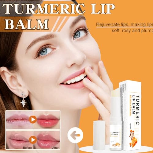 Ginger Lip Lightening for Dark Lips,Lips Pink Bleaching Cream Balm,Lip Balm,Fast Moisturizing Lightening Lip Balm,Brightening Cream Blam,Lip Care Lightens Remove Dark Lips,Lip Pigmentation Treatment - Image 8