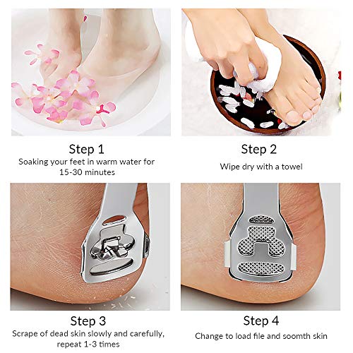 image for Codream Pedicure Callus Shaver Foot File Care Hard Skin Remover Callus