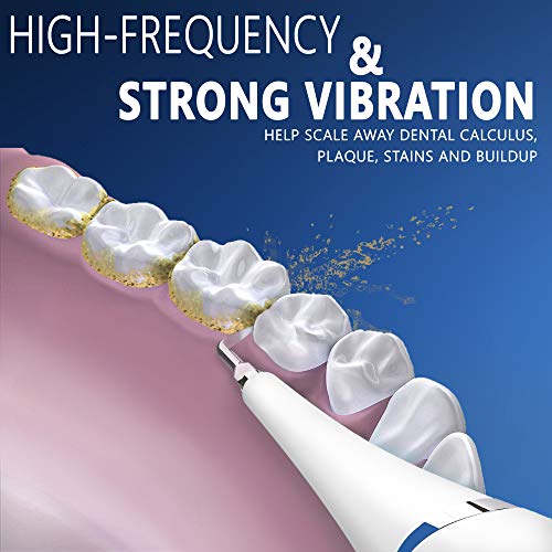Tartar, Plaque Remover For Teeth Cleaning Kit - Tooth Cleaner - Dental Calculus Remover - Removes Calculus, Stain, Plaque, Tartar - Teeth Cleaning Tool (White)