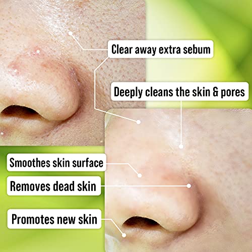 W-BEAUTY-Face-Polish-Peeling-Gel-Tea-Tree-120ml-405-fl-oz-Gommage-Skin-exfoliator-Helps-Dead-Skin-Removal-Deep-Cleansing-dull-and-flaky-skin-clogged-pores