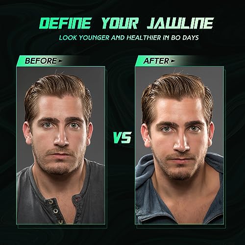 CJing Exercitador de mandíbula para homens e mulheres – Tabletes de silicone para exercícios de mand