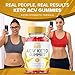 All Star Keto ACV Gummies, Allstar Keto Gummies Advanced Loss Supplement Support Management ACV+BHB Formula, AllStarKeto Wait Premium Vitamin Blend Max Strength Energy for Men Women (60 Gummies)