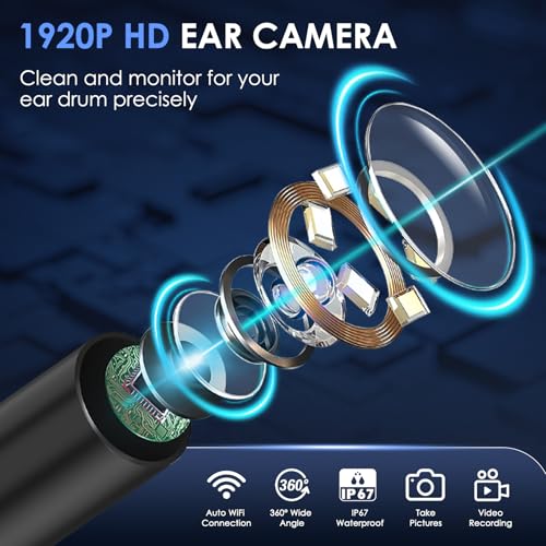 Xylla Ohrenschmalz Entferner Otoskop 1920P HD-Ear Wax Removal IP67 Wasserdicht WIFI Otoskop 360°Weitwinkel ohrreiniger mit 6 LEDs Tragbares Vergnügen der Ohrreinigungr (Schwarz)