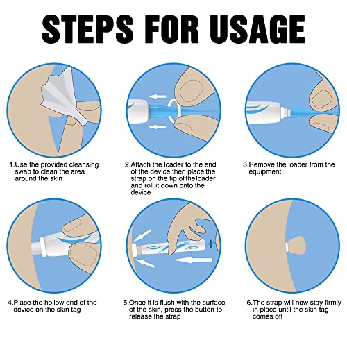 Foreverup Stielwarzen Entfernen Schnell Kit, Skin Tag Entferner, 2 In 1 Skin Tag Remover, Auto Skin Tag Remover Kit für… - Image 4