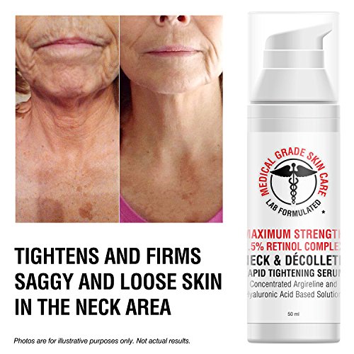 best moisturizer for crepey neck