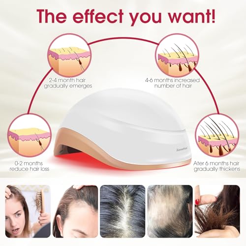 Image of Laser Hair Growth Helmet, Laser Red Light Therapy for Hair Growth, Laser Cap for Hair Regrowth Stimulate Denser Fuller Hair,256 Laser Diodes