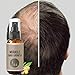 Produktbild Haarwachstum Serum,Serria® Haarserum Anti-Haarausfall natürliche Kräuteressenz Haarwachstum Spray für dünnes Haar, Verdickung & Nachwachsen Behandlung gegen Haarausfall Haarwurzeln stärken (50ml)