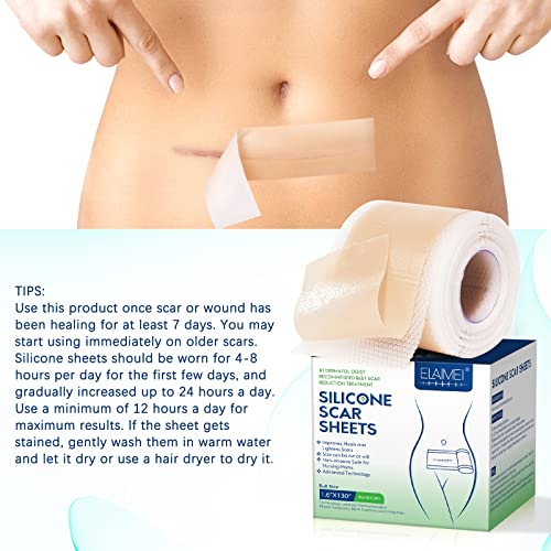 Silicone Scar Sheets (1.6”X 130”, 3.3M), Professional Silicone Scar Tape, Silicone Scar Strips, Reusable Scar Removal Sheets For Surgical Scars, C-Section, Surgery, Burn, Keloid, Acne #TOP4