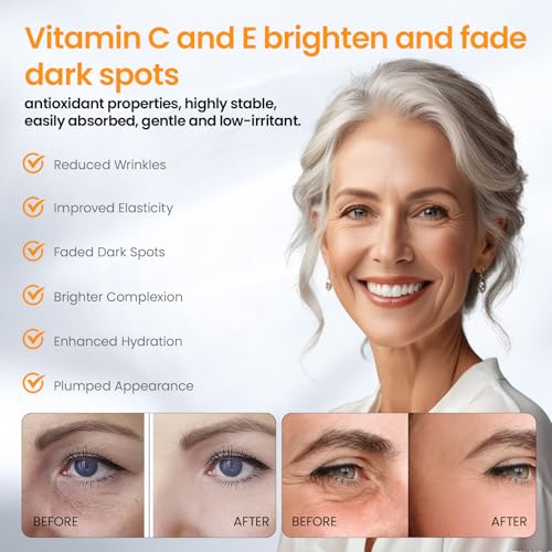 Image of Vitamin C Serum for face with Hyaluronic Acid, Vitamin E, Tri-Peptide & B5 Dark Spot Remover, Anti-Aging, Firming, Brightening & Lifting for Mature Skin, 1 fl oz