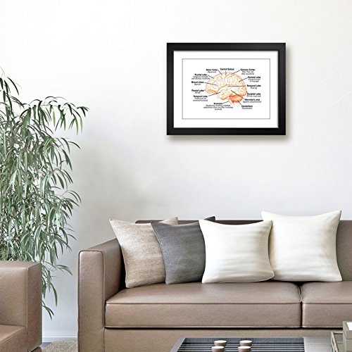 Quadro Medicina Anatomia Cerebro Humano Medico Decorativo Clinica Hospital Consultorio Moldura e Pas