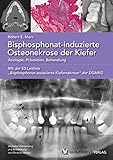 Bisphosphonat-induzierte Osteonekrose der Kiefer: Ätiologie, Prävention, Behandlung
