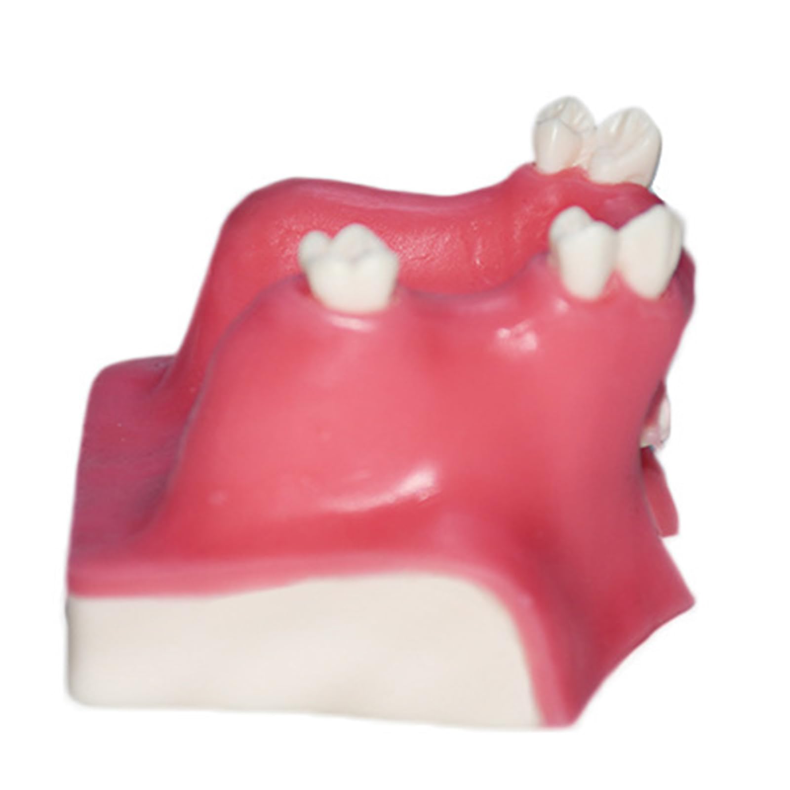 Modello di impianto Dentale - Modello di impianto mandibolare Medico e odontoiatrico - per Studio didattico Displaymedical Model，A9 8cm