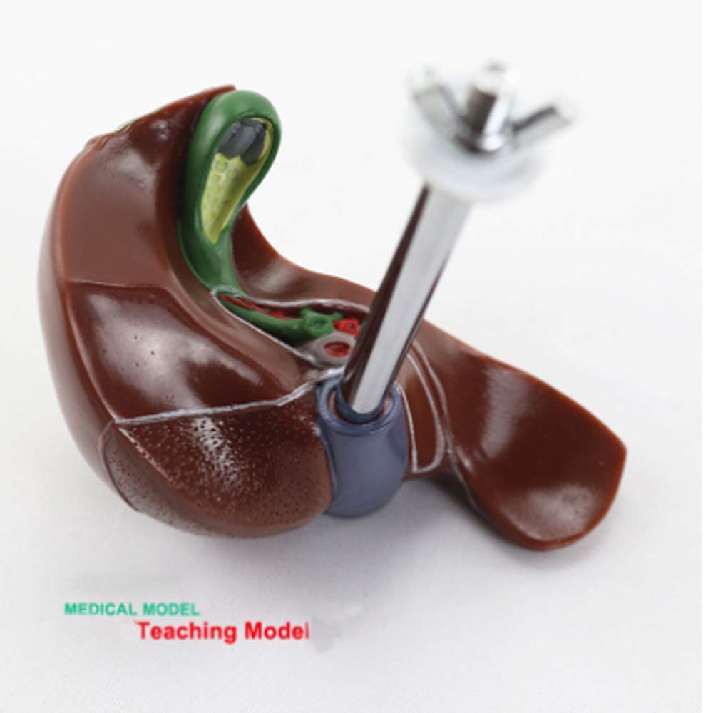 Model Edukacyjny Model Anatomiczny Patologia Wątroby Człowieka Kamień Anatomiczny Model Dla Badań Pedagogicznych Medycznych Materiały Dydaktyczne Laboratorium Demonstracyjne