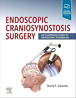 Endoscopic Craniosynostosis Surgery: An Illustrated Guide to Endoscopic Techniques