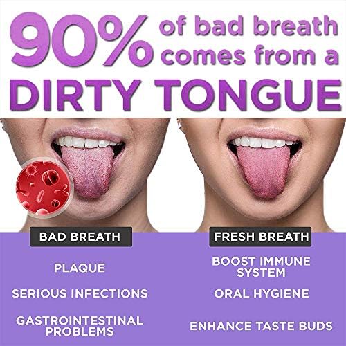 Tongue Scraper Stainless Steel,Tongue Cleaners Fresh Breath Restored Taste U Shape