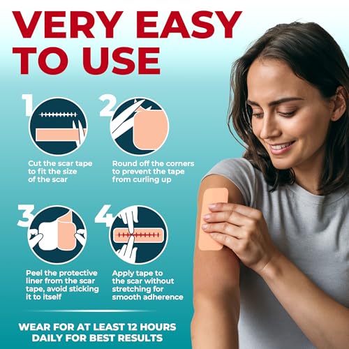 medical grade silicone scar tape - 16x150 - visible difference on keloid amp -section - reusable silicone scar sheets - easy to use