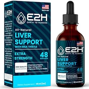 Milk Thistle Extract for Liver Cleanse Detox & Repair – Herbal Liver Support Supplement with Artichoke Extract, Dandelion Root, Chanca Piedra, and More – 2 Fl Oz by E2H