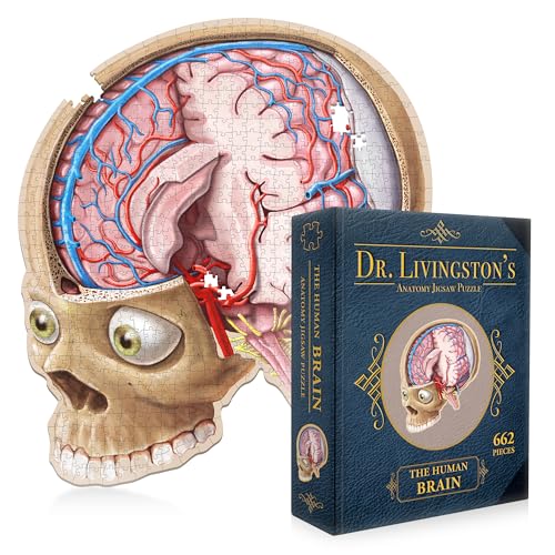 Dr. Livingston's Human Brain Anatomy Puzzle