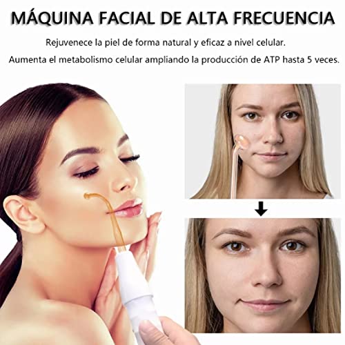 Opiniones y reviews de Radiofrecuencia facial del mes. 24 Imagen adicional