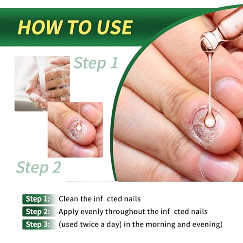 2PCS Ginger Nail Treatments,Nail Treatment,Ginger Nail Growth Serum - Image 3