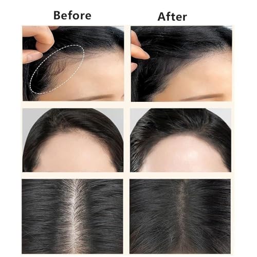 Image of Instant Natural Hairline Colour Touch-Up Powder for Women & Men, Natural Shadow Filler & Shading Sponge Pen for Thinning Hair, Quick Root Touch-Up & Hairline Concealer (BLACK HAIR STICK POWDER)