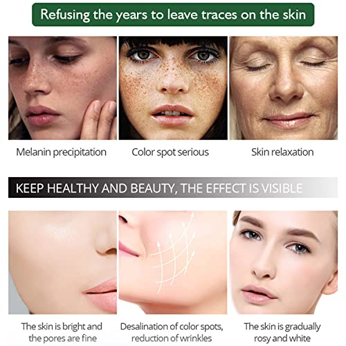 Aichun Beauty Facial Serum Anti-Freckle Essence Nicotinamide Green Tea Extract Moisturizing Smooth Delicate 30Ml/1Fl.oz #TOP2