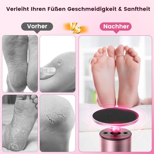 2-IN-1 Hornhautentferner Elektrisch, Wiederaufladbarer Hornhaut Entfernen Fuß 6 Stufen Einstellbar mit Austauschbaren Fußfeilen, Pediküre Set für rissige Fersen Hornhaut harte Haut