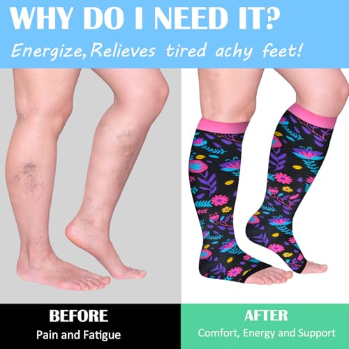 Open Toe Compression Socks for Women 3 pairs Toeless Sock Wide Calf Knee High Support Sock3