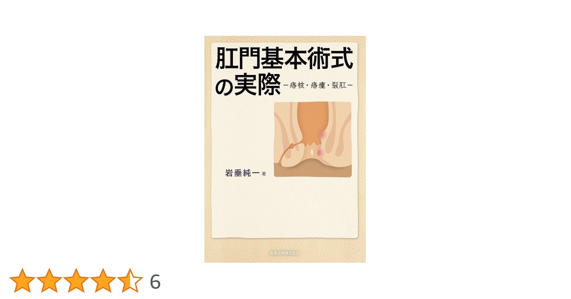 肛門基本術式の実際: 痔核・痔瘻・裂肛 肛門基本術式の実際: 痔核・痔瘻・裂肛 | 岩垂純一 |本 | 通販