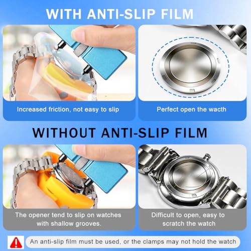 Image of Serplex Watch Repair Tool Kit with Case Opener, Tweezers, Precision Screwdriver & Case Holder, Watch Back Removal Tool Set with Accessories for Battery Replacement, Only for Grooved Watches