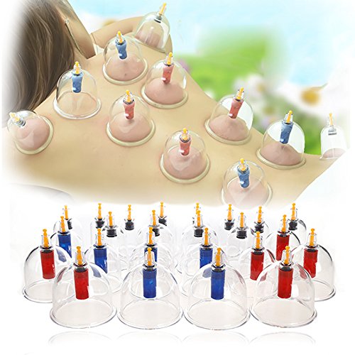 VENDEUR PRO Schröpfen Set mit 24 Schröpfgläser aus Kunststoff Glas Cupping Set Vakuum Massage Cover